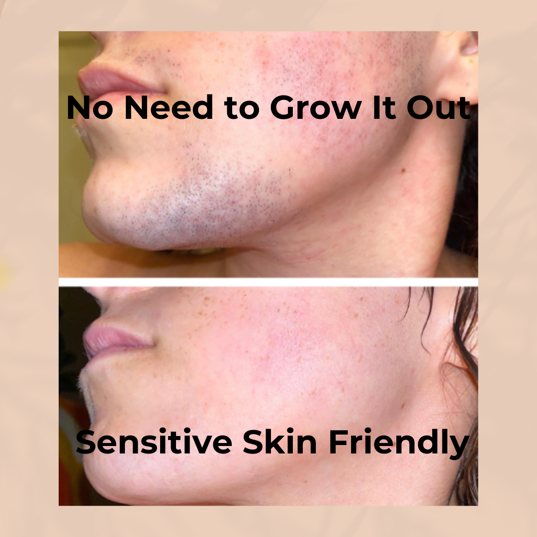 🔥Mother's Day HOT SALE 50% OFF🎁 Hair Removal Kit🔥💥
